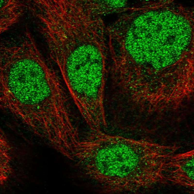 Immunocytochemistry/ Immunofluorescence Zinc finger protein 180 Antibody - BSA Free