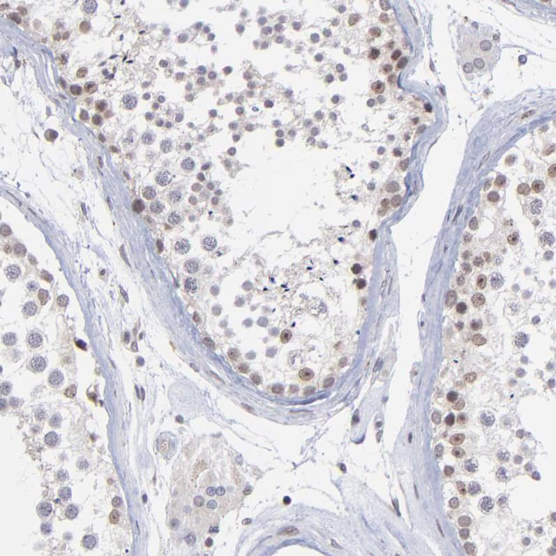 Staining of human testis shows moderate nuclear positivity in a subset of cells in seminiferous ducts.