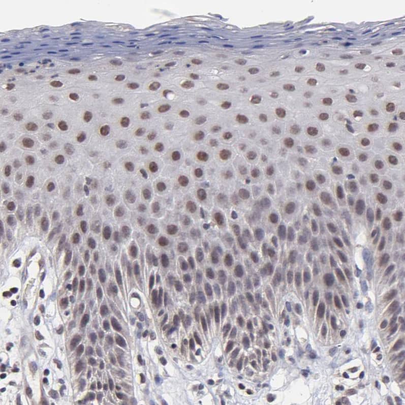 Staining of human skin shows strong nuclear positivity in squamous epithelial cells.