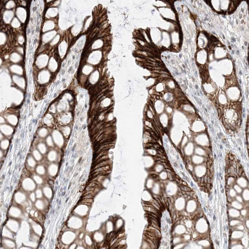 Staining of human colon shows strong cytoplasmic and membranous positivity in glandular cells.