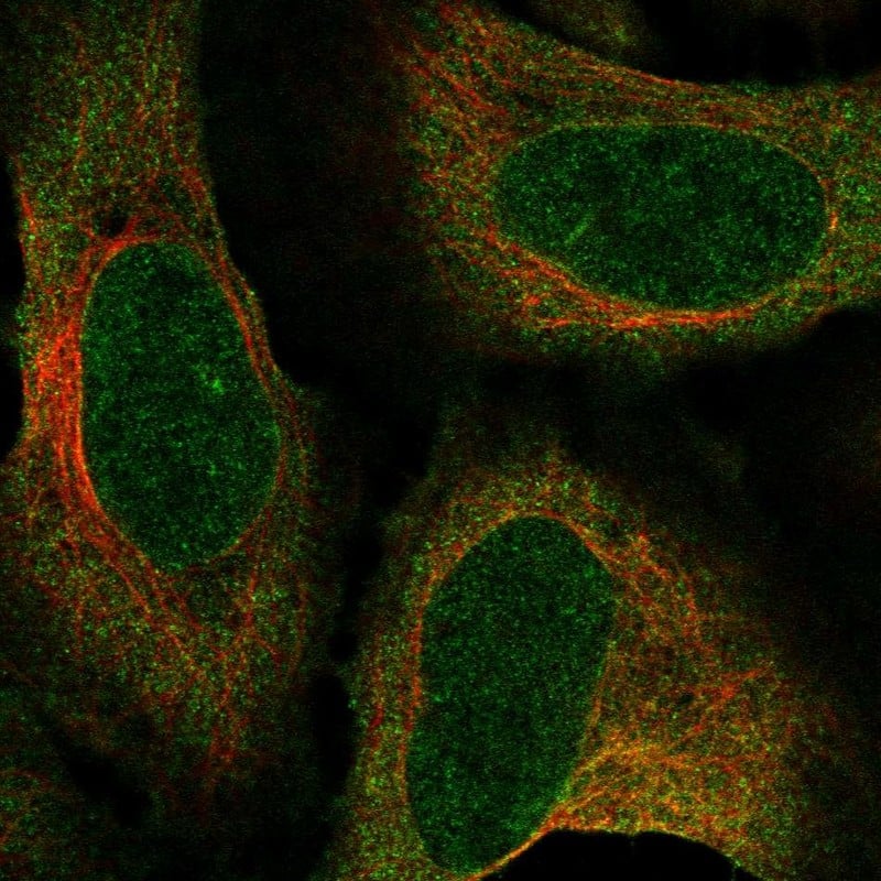 Staining of human cell line U-2 OS shows localization to nuclear membrane & cytosol.