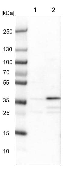 Western Blot ZNF609 Antibody - BSA Free