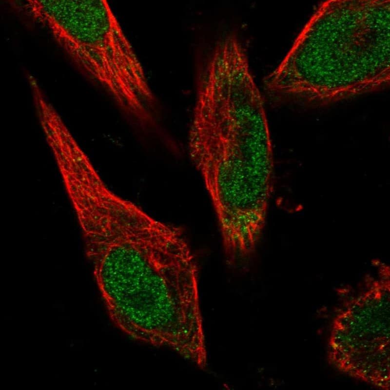 Staining of human cell line U-251 MG shows localization to nucleoplasm & cytosol.