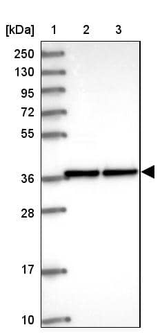 Western Blot ZNF707 Antibody - BSA Free