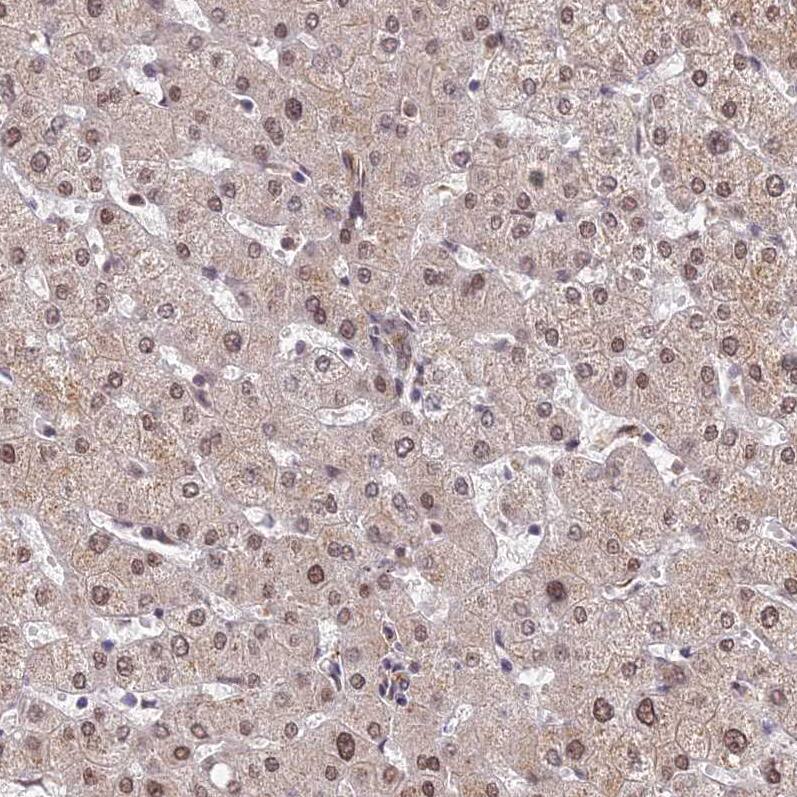 Staining of human liver shows moderate nuclear positivity in hepatocytes.