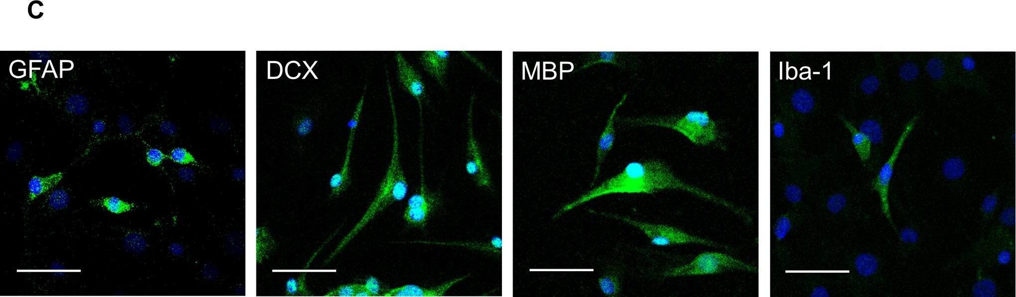 Experimental flow diagram and culture of HAP stem cells.(B) Procedure for culture and colonization of HAP stem cells. Bar = 200 μm. (C) Immunofluorescence staining shows that the cultured HAP stem cell colonies differentiated to GFAP-positive astrocytes, DCX-positive neurons, MBP-positive oligodendrocytes and Iba-1-positive microglia on Lab-Tek chamber slides. Green = GFAP, DCX, MBP or Iba-1; Blue = DAPI. Bar = 50 μm. Image collected and cropped by CiteAb from the following open publication (//pubmed.ncbi.nlm.nih.gov/36638123), licensed under a CC-BY license. Not internally tested by Novus Biologicals.