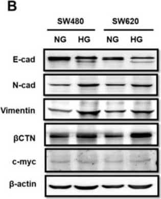 Western Blot: Vimentin Antibody (2D1) [NBP1-92687] - High glucose (HG) concentrations induced epithelial-to-mesenchymal transition protein expression & enhanced migration activity in colorectal cancer (CRC) cells. SW480 (low metastatic potential) & SW620 (high metastatic potential) cells were cultured in different concentrations of glucose (normal: NG; HG; & osmotic control: NG + l-glucose). (A) Morphological change occurred from epithelial to mesenchymal type in the HG-concentration group. (B) HG concentration caused downregulation of E-cadherin & upregulation of N-cadherin,  beta CTN, & vimentin, but c-myc was unchanged, as detected using Western blotting.  beta -actin was evaluated as an internal control. (C,D) Wound healing assay showed that HG concentration promoted cell motility in SW480 & SW620 CRC cells after 48 & 72 h of culture, compared with the NG & NG + l-glucose groups. (E) In a Transwell migration assay, 3.5 × 105 SW480 & SW620 CRC cells were plated onto a 24-well plate & cultured in NG & HG-concentration medium for 96 h. HG concentration promoted cell motility in SW480 & SW620 cells. NG + l-glucose cells were evaluated as ostomic controls. (F) These data show that HG concentration caused upregulation of p-IGF1R in CRC. In addition, HG concentration promoted IGF1R downstream signaling, including p-Src & p-ERK; these proteins were increased when CRC cells were cultured in HG-concentration medium. Levels of  beta -actin were evaluated as loading controls. Statistically significant differences between the two groups were judged using Student’s t-tests; * p < 0.05, ** p < 0.005, *** p < 0.001; n.s. = nonsignificant. Image collected & cropped by CiteAb from the following publication (//pubmed.ncbi.nlm.nih.gov/30965609), licensed under a CC-BY license. Not internally tested by Novus Biologicals.