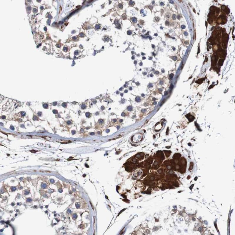 Staining of human testis shows strong cytoplasmic positivity in Leydig cells.