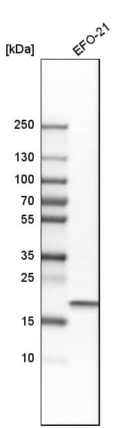 Analysis in human cell line EFO-21.