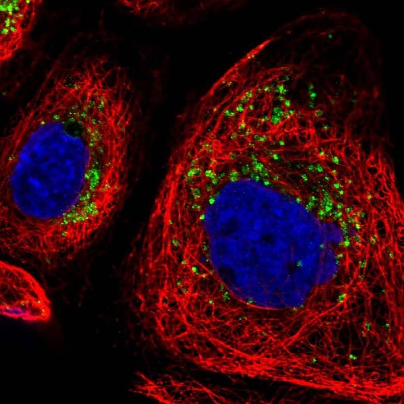 Staining of human cell line A-431 shows localization to the Golgi apparatus & vesicles.