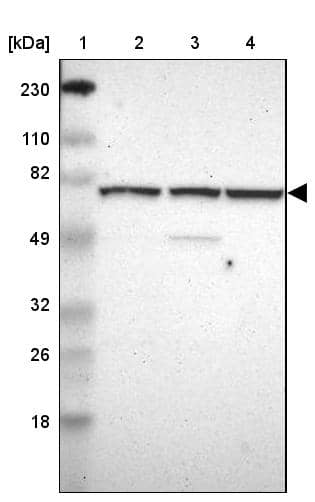 Lane 1: Marker [kDa] 230, 110, 82, 49, 32, 26, 18Lane 2: Human cell line RT-4Lane 3: Human cell line U-251MG spLane 4: Human plasma (IgG/HSA depleted)