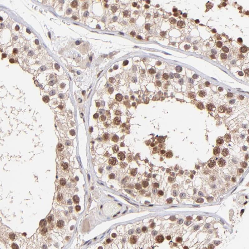 Staining of human testis shows moderate nuclear cytoplasmic positivity in cells in seminiferous ducts.
