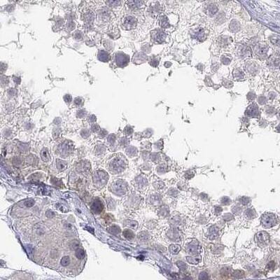 Staining of human testis.