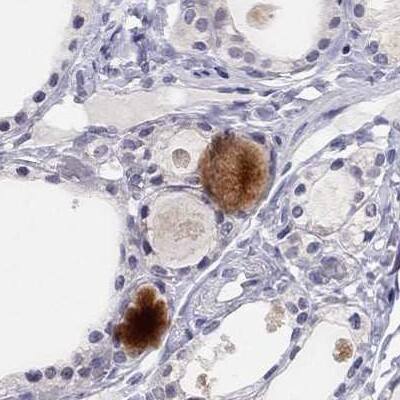Staining of human thyroid gland.