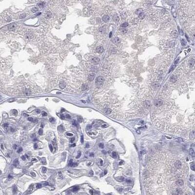 Staining of human kidney.