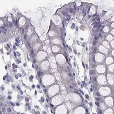 Staining of human colon.