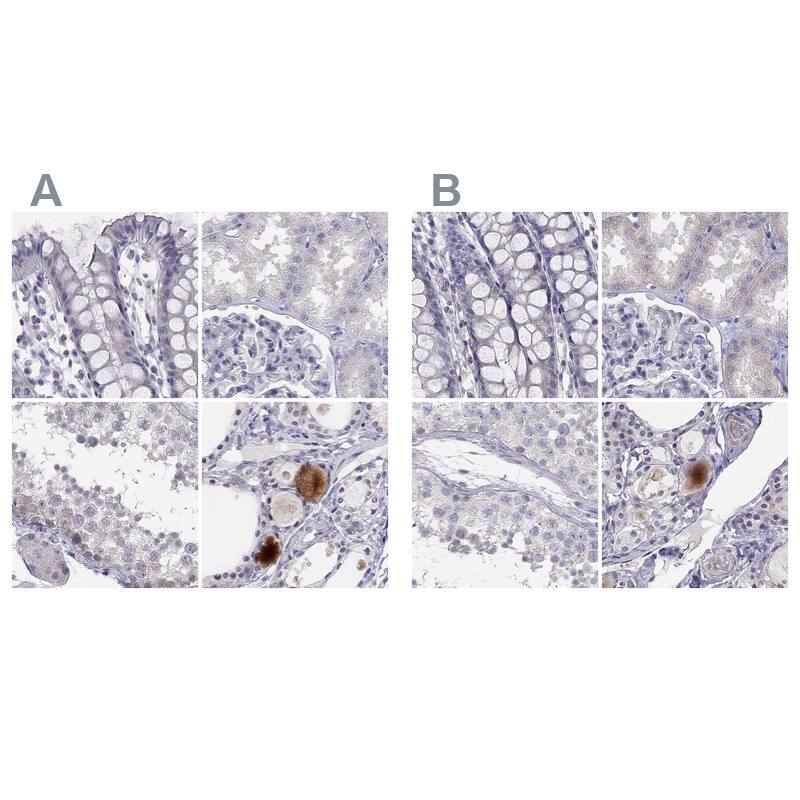 <b>Orthogonal Strategies Validation. </b>Staining of human colon, kidney, testis and thyroid gland HPA013613 (A) shows similar protein distribution across tissues to independent antibody HPA016934 (B).