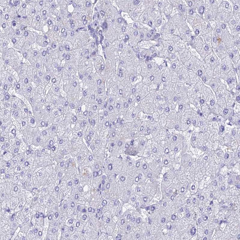 Staining of human liver shows no positivity in hepatocytes as expected.