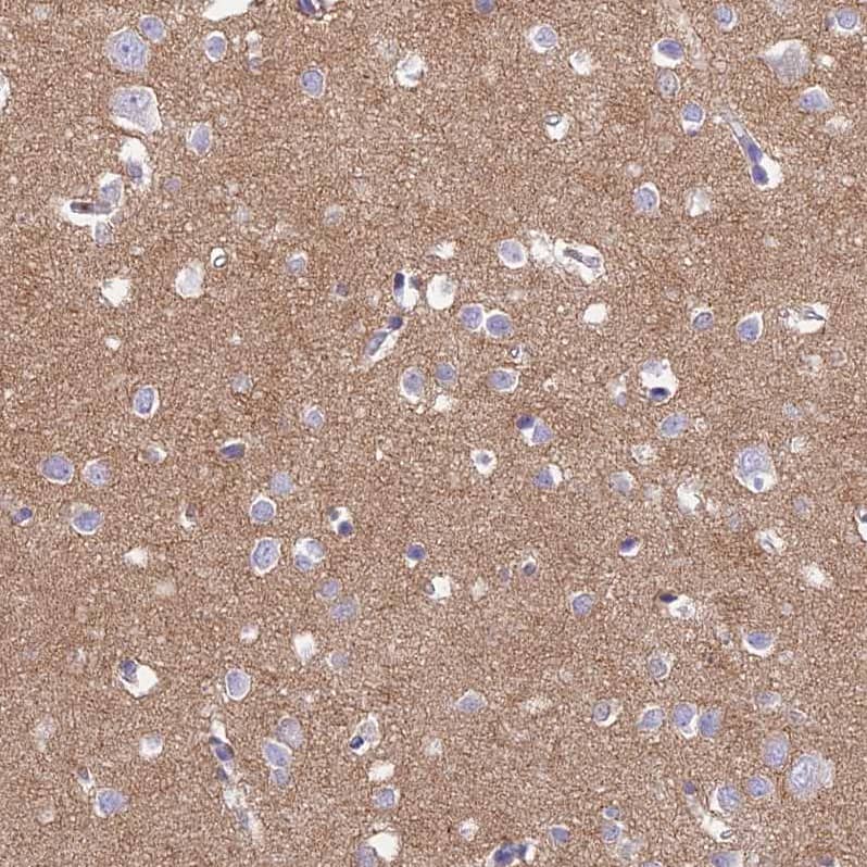 Staining of human cerebral cortex shows moderate cytoplasmic positivity in neuropil.