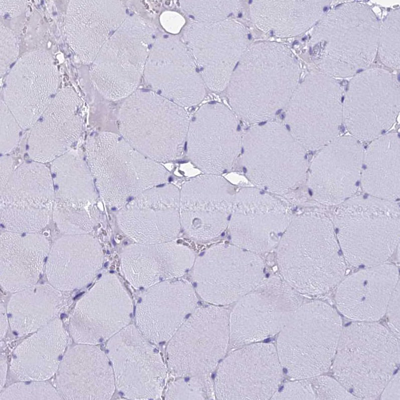Staining of human skeletal muscle shows no positivity in myocytes as expected.