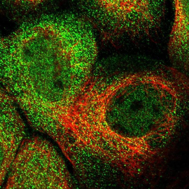 Staining of human cell line A-431 shows localization to nucleoplasm & cytosol.