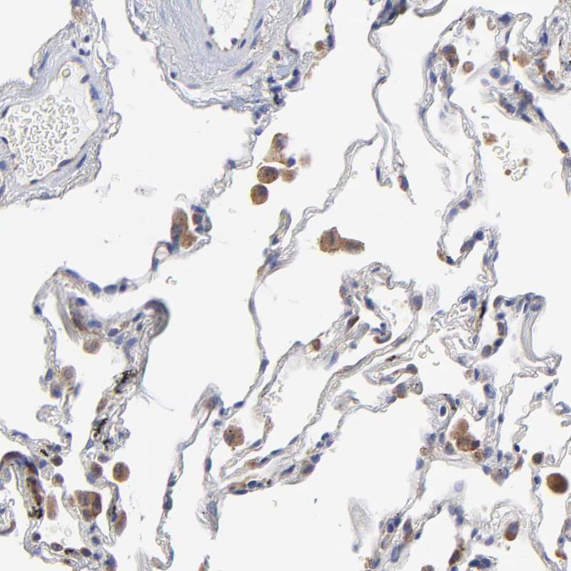 Staining of human lung shows moderate cytoplasmic positivity in macrophages.