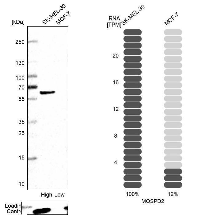 Analysis in human cell lines SK-MEL-30 and MCF-7 using Anti-MOSPD2 antibody. Corresponding MOSPD2 RNA-seq data are presented for the same cell lines. Loading control: Anti-PFN1.