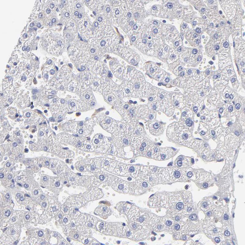 Staining of human liver shows weak cytoplasmic positivity in Kupffer cells.