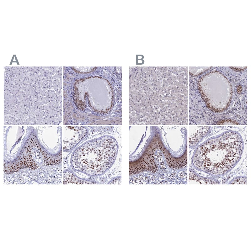 <b>Orthogonal Strategies Validation. </b>Staining of human liver, prostate, squamous epithelia and testis HPA041117 (A) shows similar protein distribution across tissues to independent antibody HPA041540 (B).