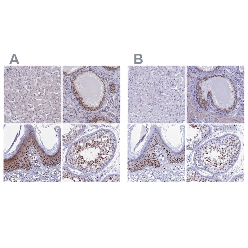 <b>Orthogonal Strategies Validation. </b>Staining of human liver, prostate, squamous epithelia and testis HPA041540 (A) shows similar protein distribution across tissues to independent antibody HPA041117 (B).