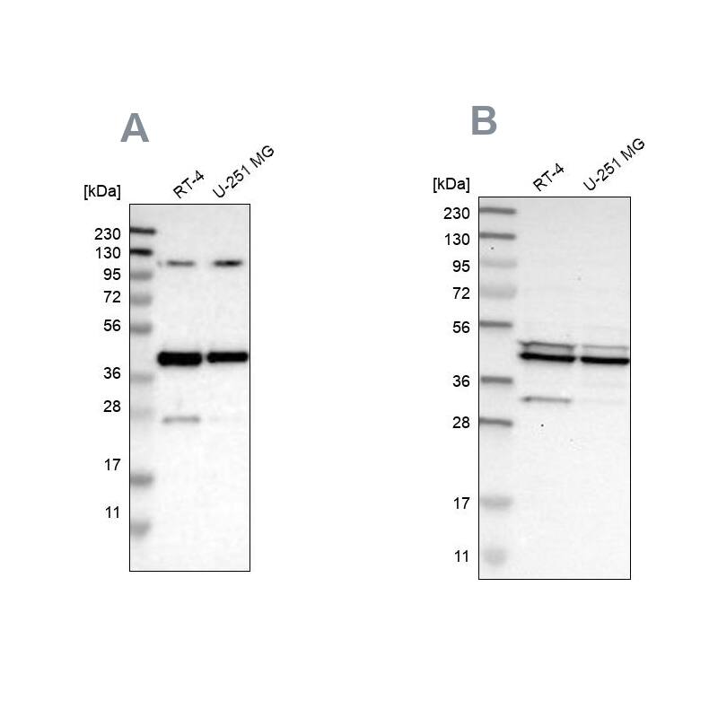 <b>Independent Antibodies Validation. </b>Analysis using antibody NBP1-93514 (A) shows similar pattern to independent antibody NBP1-93513 (B).