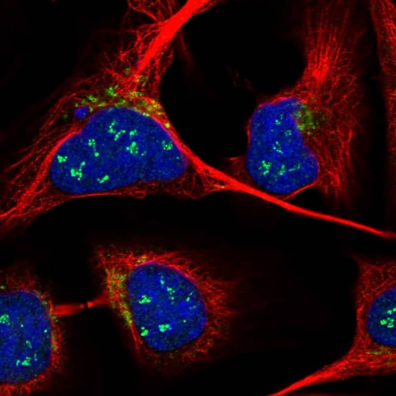 Immunocytochemistry/ Immunofluorescence ANKRD40 Antibody - BSA Free