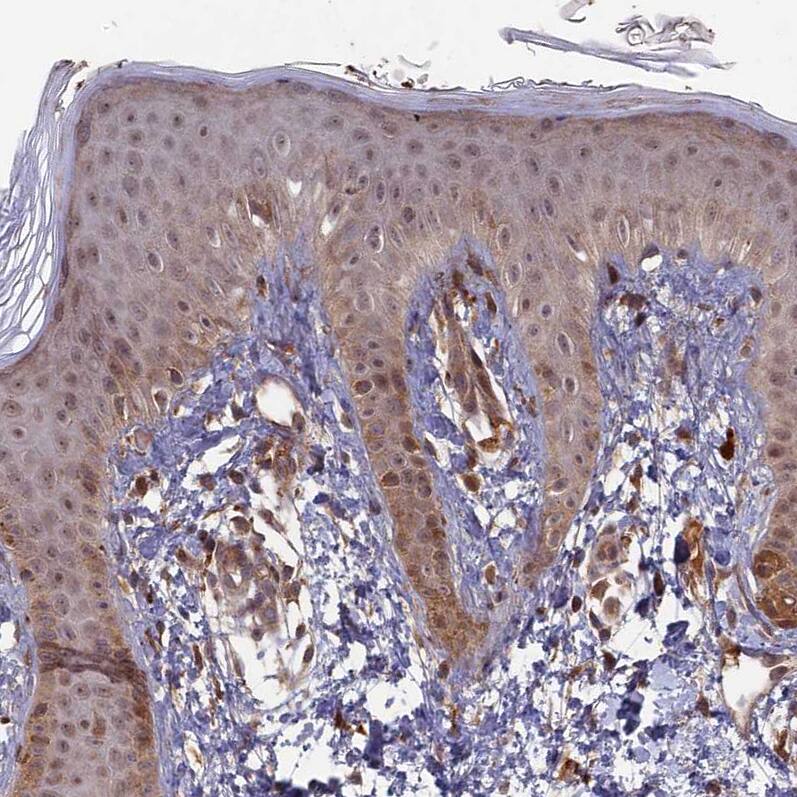 Staining of human skin shows moderate cytoplasmic positivity in squamous epithelial cells.