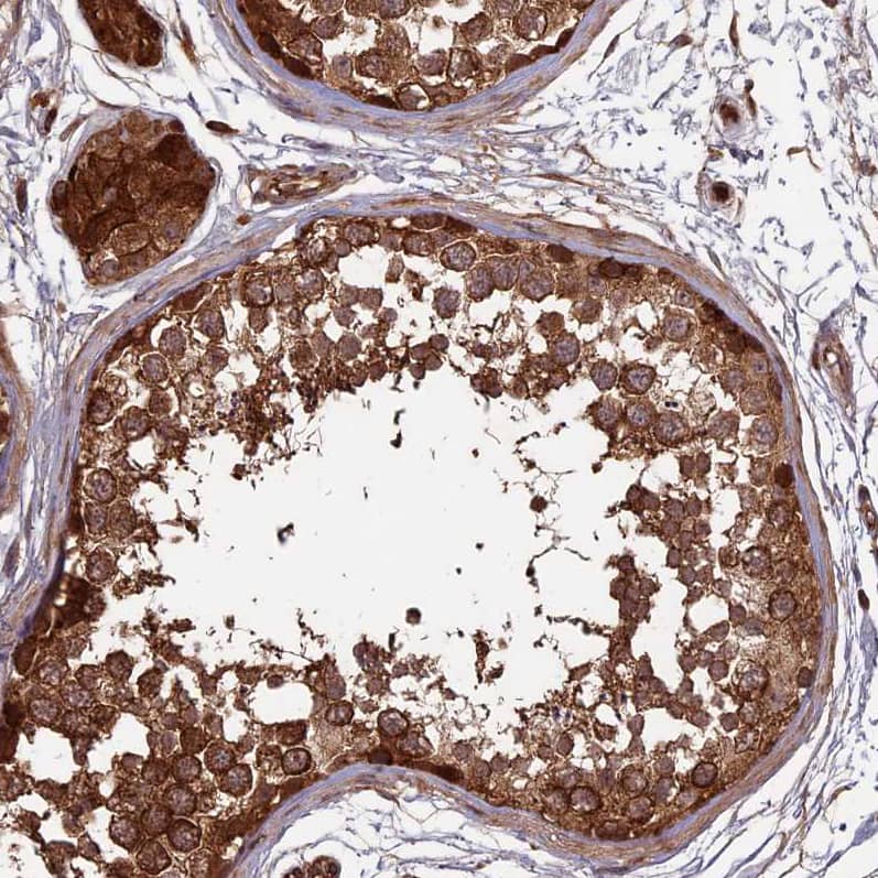 Staining of human testis shows strong cytoplasmic positivity in cells in seminiferous ducts.