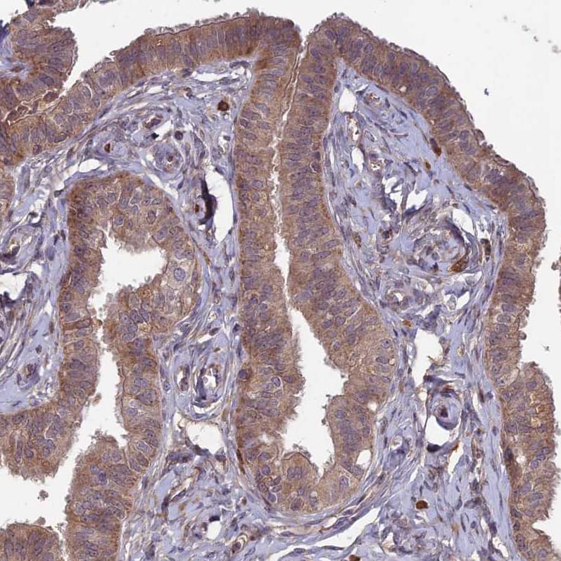 Staining of human fallopian tube shows moderate cytoplasmic positivity in glandular cells.
