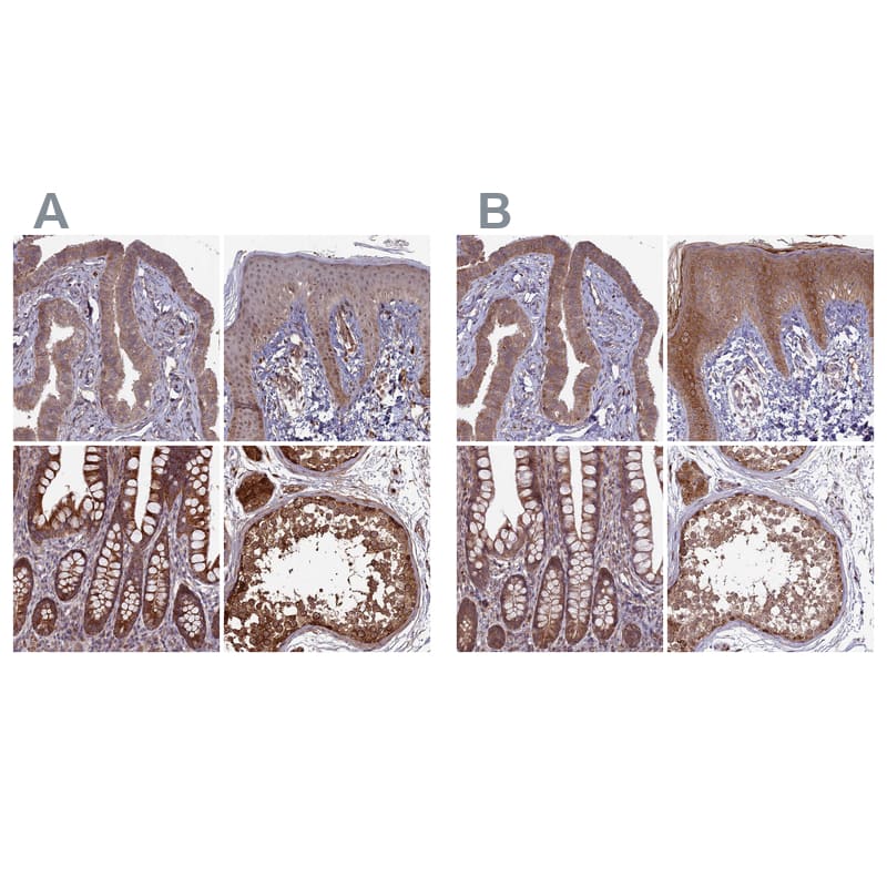 Staining of human fallopian tube, skin, small intestine and testis HPA040776 (A) shows similar protein distribution across tissues to independent antibody HPA039683 (B).