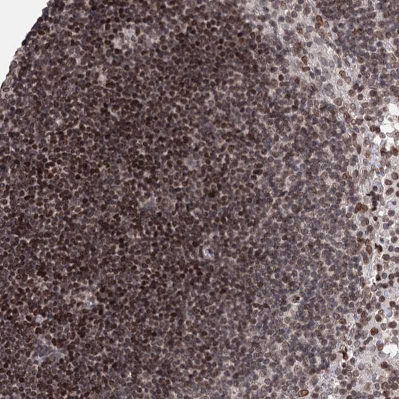 Staining of human lymph node shows moderate nuclear and cytoplasmic positivity in germinal and non-germinal center cells.