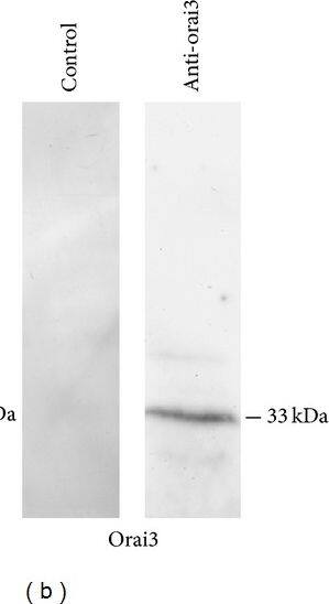 Expression of Stim1-2, Orai1, Orai3, TRPC1, and TRPC3/6/7 proteins in mRCC cells. Expression of Orai1, 3, Stim1, 2, TRPC1, and TRPC3/6/7 proteins in mRCC. Blots representative of two were shown. Lanes were loaded with 30 μg of proteins, probed with affinity purified antibodies and processed as described in Section 2. Major bands of the expected molecular weights were observed. Bands were acquired with the Image Master VDS (Amersham Biosciences Europe, Italy).  beta -actin (d) has been exploited as housekeeping protein. Image collected and cropped by CiteAb from the following open publication (//pubmed.ncbi.nlm.nih.gov/25126575), licensed under a CC-BY license. Not internally tested by Novus Biologicals.