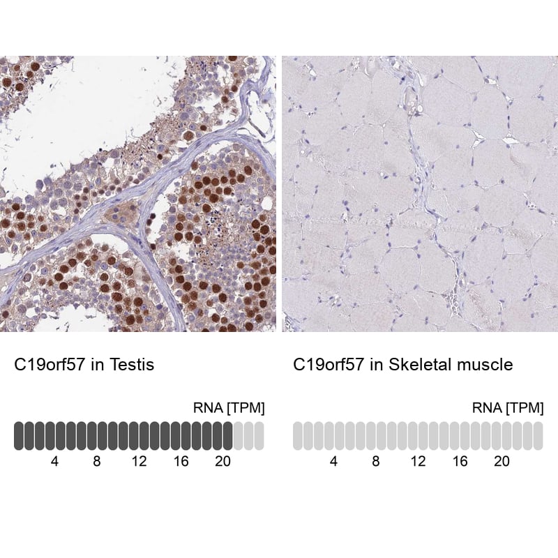 Analysis in human testis and skeletal muscle tissues using Anti-C19orf57 antibody. Corresponding C19orf57 RNA-seq data are presented for the same tissues.
