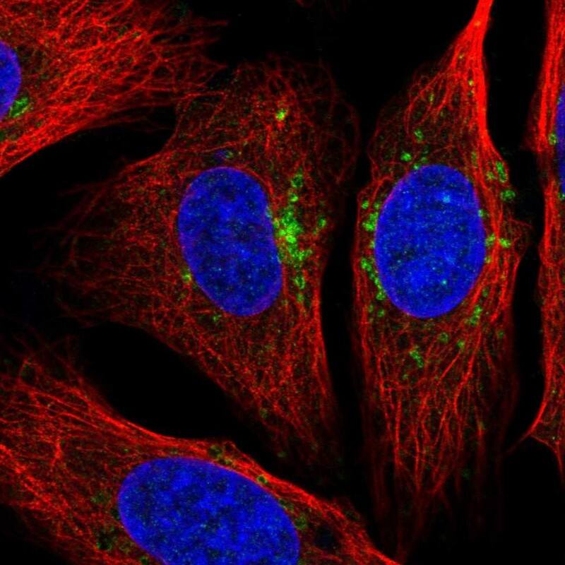 Staining of human cell line U-2 OS shows localization to vesicles.