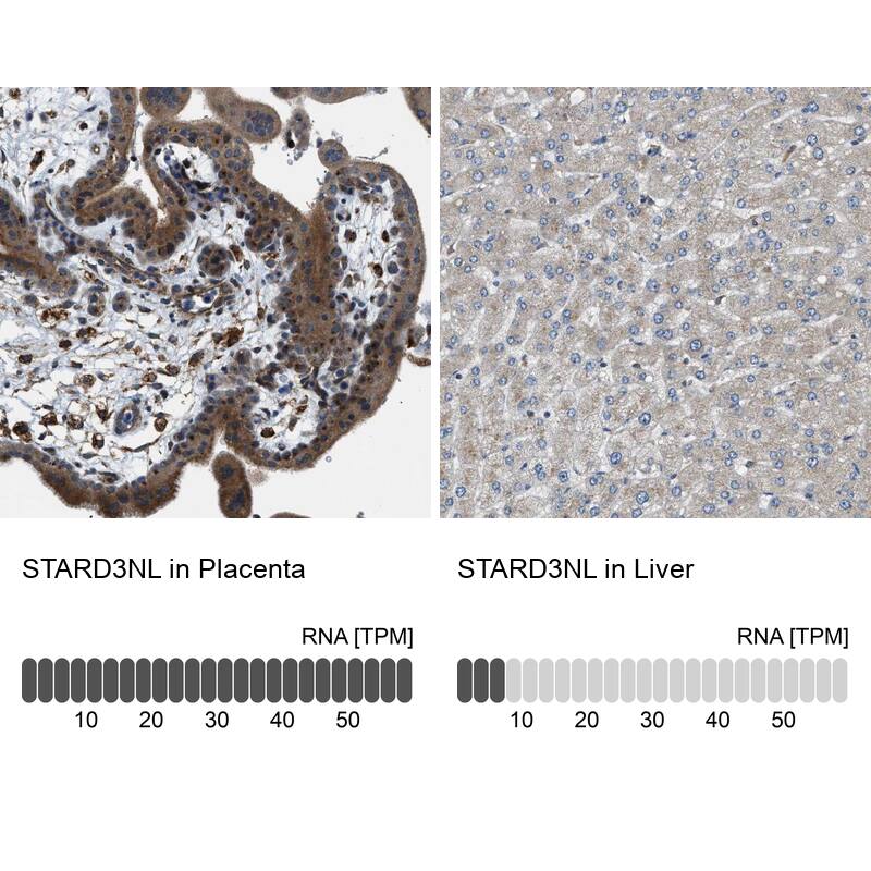 <b>Orthogonal Strategies Validation. </b>Analysis in human placenta and liver tissues using NBP1-93527 antibody. Corresponding STARD3NL RNA-seq data are presented for the same tissues.
