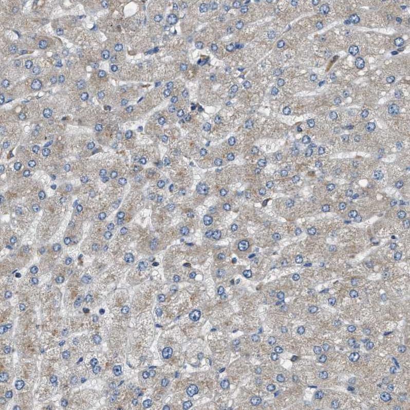 Staining of human liver shows very weak positivity in hepatocytes.