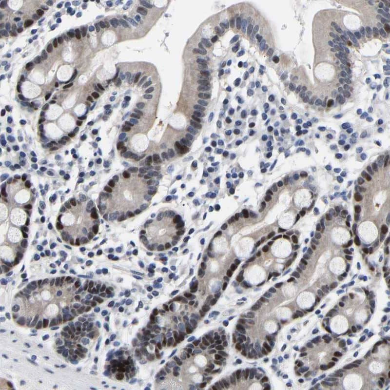 Immunohistochemistry-Paraffin PTRHD1 Antibody - BSA Free