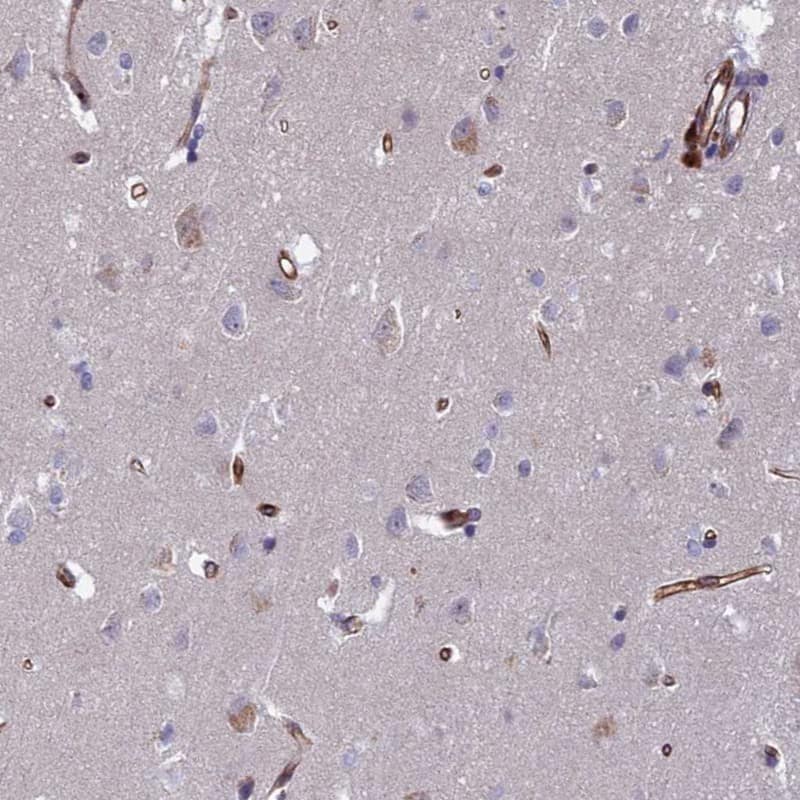 Staining of human cerebral cortex shows distinct positivity in endothelial cells.