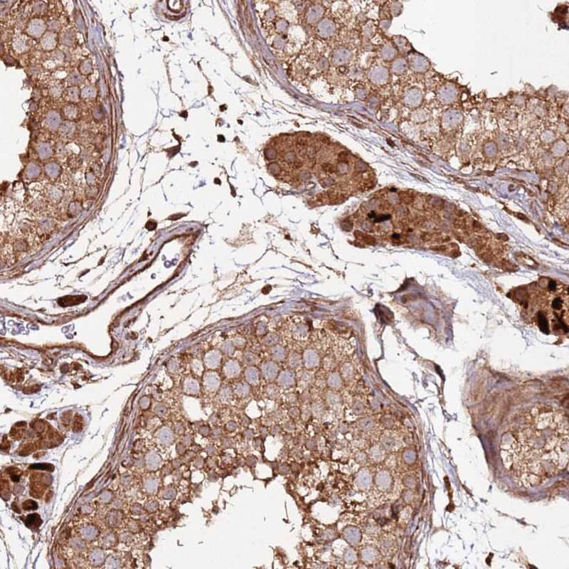Staining of human testis shows strong cytoplasmic positivity in cells in seminiferous ducts and Leydig cells.