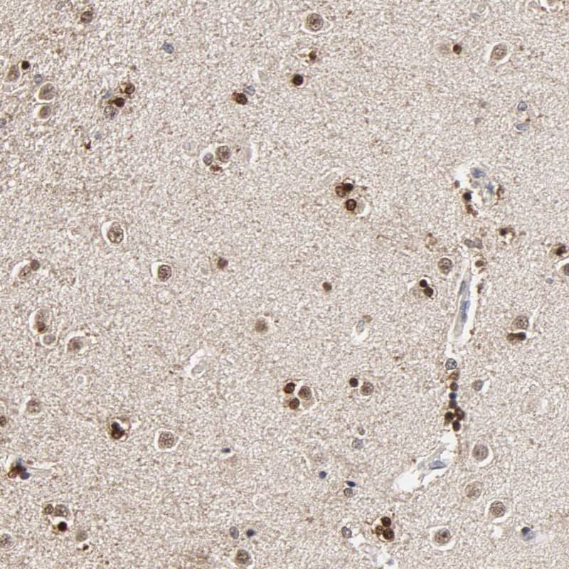 Staining of human caudate shows strong nuclear positivity in glial cells.