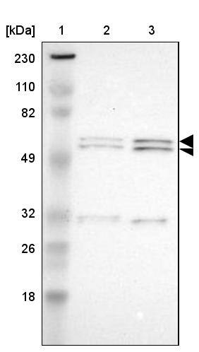 Lane 1: Marker [kDa] 230, 110, 82, 49, 32, 26, 18Lane 2: Human cell line RT-4Lane 3: Human cell line U-251MG sp