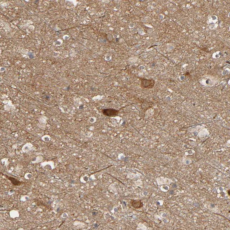 Staining of human cerebral cortex shows moderate to strong cytoplasmic positivity in neurons.