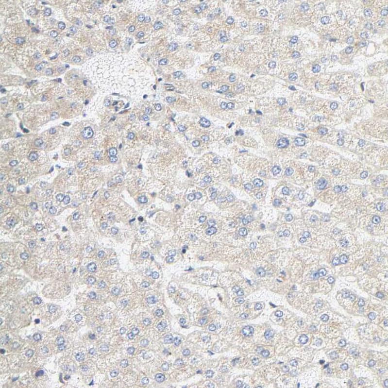 Staining of human liver shows no positivity in hepatocytes.