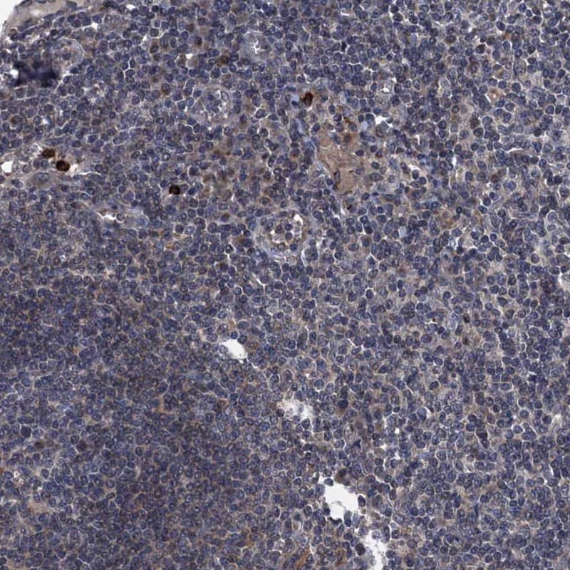 Immunohistochemistry-Paraffin KBTBD8 Antibody - BSA Free